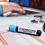 medical office work table with a blood sample from a patient positive for monkey pox virus (MPXV). Doctor's work table with a blood tube diagnosed infection with Monkeypox (MPXV) disease